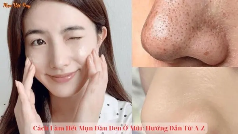 Cách Làm Hết Mụn Đầu Đen Ở Mũi: Hướng Dẫn Từ A-Z