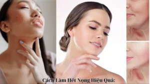 Cách Làm Hết Nọng Hiệu Quả: Những Phương Pháp Đơn Giản Tại Nhà