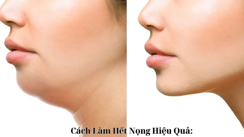 Cách Làm Hết Nọng Hiệu Quả: